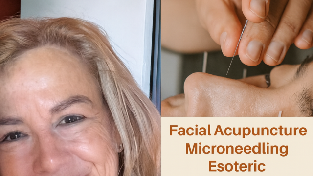 259B2E3D-1156-46FE-BFFB-FD982B78BC22