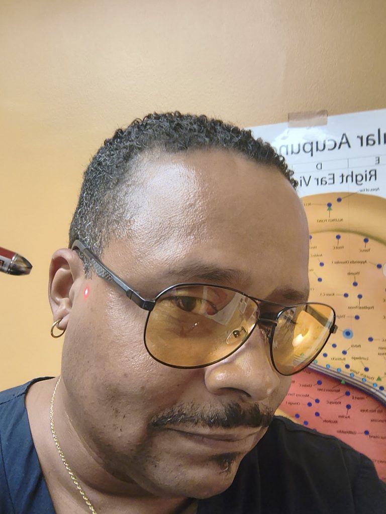 Laser-ear-tx-self